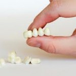 Dental Crowns And Bridges