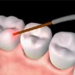 Periodontal Therapy