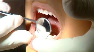 What to Do Before Seeing a Dentist Beaver WI
