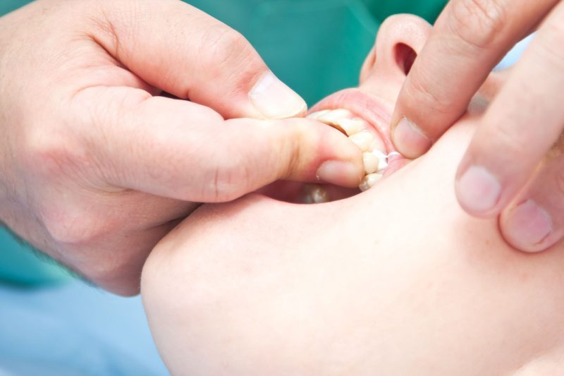Quality Cosmetic Dental Care For the Residents of Fort Collins CO