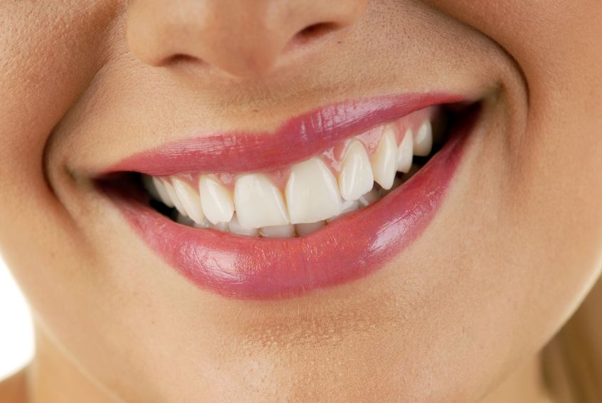 Signs You Should Consider Full Mouth Reconstruction
