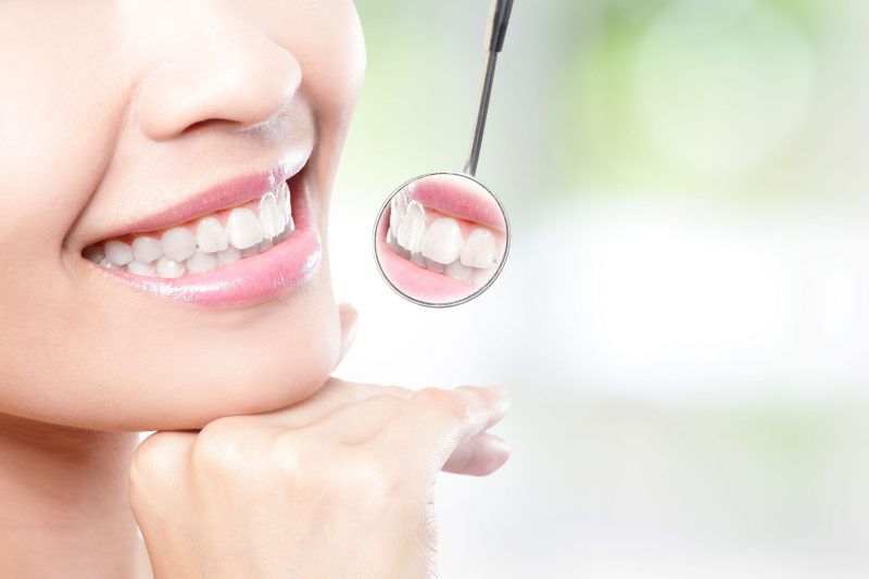 Signs a Person Could Benefit from Veneers in Salisbury NC