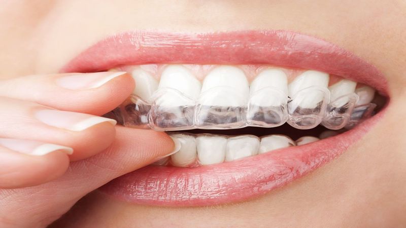 How Often Should You See the Dentist?