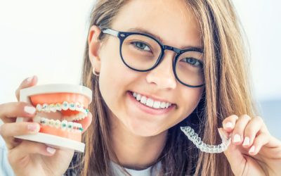 How To Get Affordable Braces In Huntington Beach